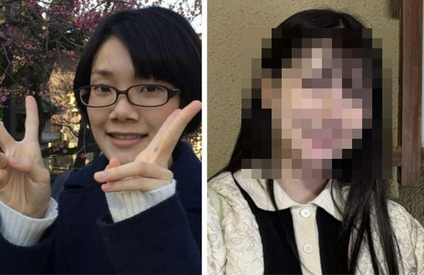 【画像】ブス女が整形した結果…めっちゃ美人に生まれ変わるｗｗｗｗｗｗｗｗｗｗｗ