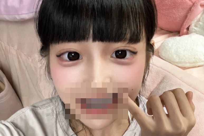 【画像】歯を全部銀歯にした女さん、発見されるｗｗｗｗｗｗｗｗｗｗｗ