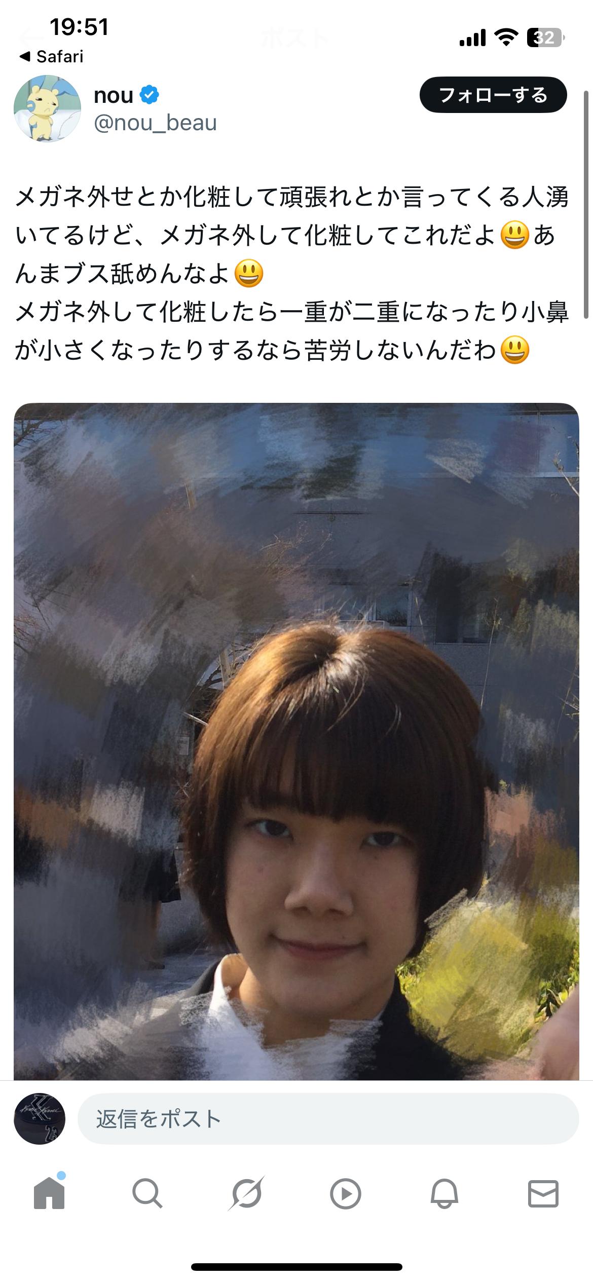 【画像】芋女さん、整形で別人に生まれ変わるｗｗｗｗｗｗｗｗｗｗｗｗｗｗｗｗｗｗｗｗｗｗ