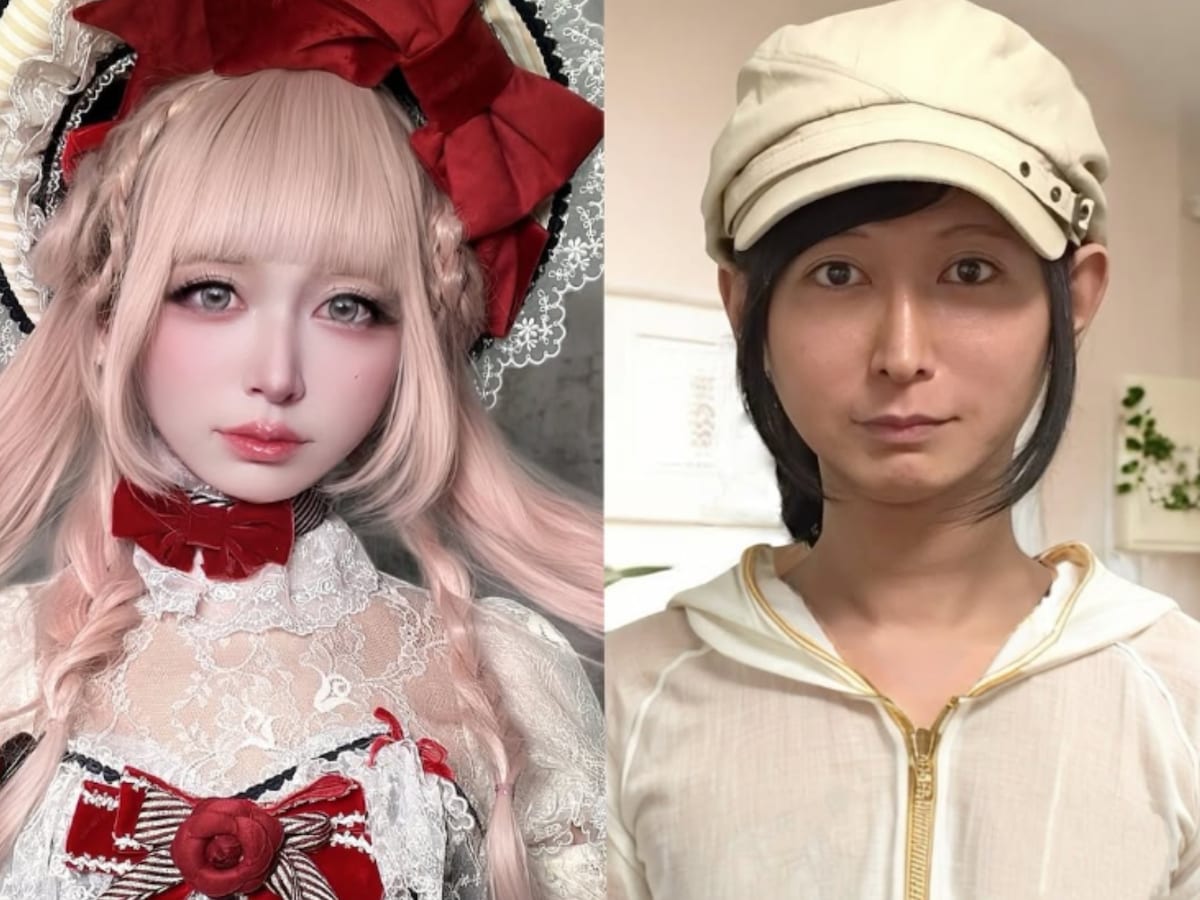 女装モデルでミュージシャンの男性(48)「手に浮き出た血管を取る」手術告白　ネット賛否！！